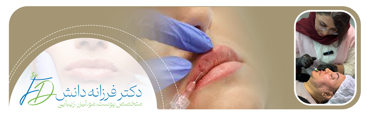 تزریق فیلر لب - کلینیک دانش