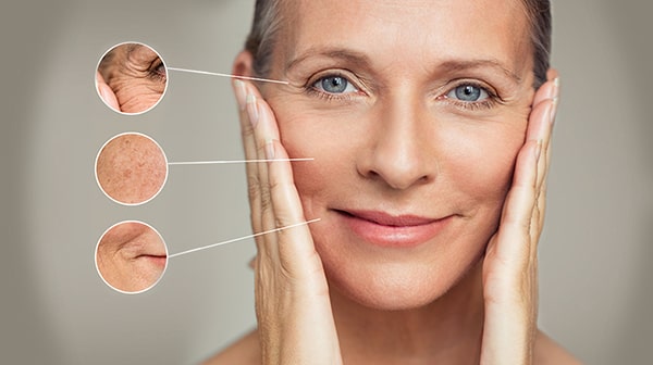 لیزر آنجلا در اصفهان